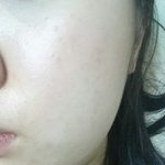 [조언부탁] 화장독 맞나요?사진유