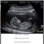 [저승사자] 낙<b>태아</b>를 처리했던 간호사 슬픈 이야기 입니다 ..