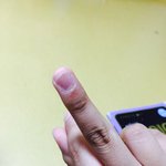 [EXO] 아 씨발 내손톱 미친 아오