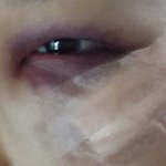 아빠가 망치로 절 때려서.. / 집행유예로 풀릴 것 같아요.