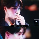 [카이] 카이 퇴근짤인데 <b>앞니</b> 정말 다친건가?