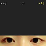 [댓글부탁해] 티안나는 <b>속</b><b>쌍</b>인데 쌍수할까?