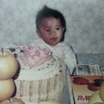 안면장애인을 아시나요?