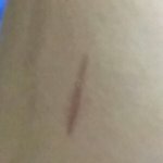 [댓글부탁해] 이거무슨<b>흉터</b>같애..?