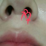 [댓글부탁] *혐오*<b>코안</b>에 여드름이