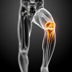 <b>안산시</b> 정형외과 관절치료 잘하는곳