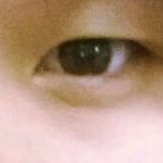 [<b>깜놀</b>]  쌍커풀의 중요성))사진ㅇ