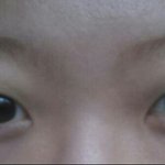 <b>쌍수</b>고민이요 