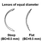 [제보합니다] 국내 렌즈회사 '네오<b>비젼</b>'의 착한 대응!!!