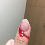 손톱까시래기 뜯는거 <b>존</b><b>잼</b>