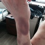 감사합니다 추후 결과 다시 올리겠습니다