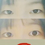 눈 이렇게 되는 사람?ㅠㅠㅠㅜ