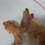 [어이없어요] 안익은 닭을 먹었는데 배아프면 연락하라는 치킨집 <b>점원</b>?