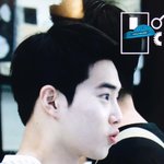 [EXO] <b>발치</b> 과정에서 애를 먹을 정도로 기괴한 모양새로 자리하고...