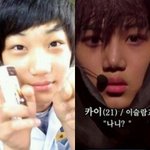 [EXO] 카이 <b>성형의혹</b>