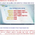 “4cm나 짧았던 다리가 길어져 예쁘게 치마도 입을 수 있어요”