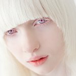 알비노병에 걸린 여성 모델