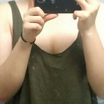 [댓글부탁] 팔지방<b>흡입</b> 후 봐주세요 ㅠㅠ