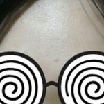 [댓글부탁해] 점뺐는데 <b>자국</b>이