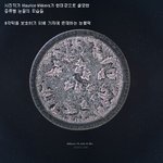 현미경으로 본 <b>각종</b> 눈물모양