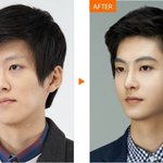 <b>남자</b>들은 성형한사람들을 왜 싫어할까?