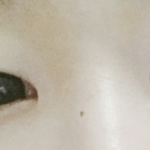 [댓글부탁해] 엄마가 강제로 쌍수ㅜㅜㅜㅜㅜㅜ