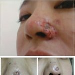 [공포] 성형의 관한 양심선언(펌)