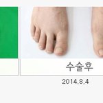 발 이런언니 나말고 또 있어? (사진 有)