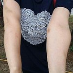 [더러운여자] 이것이 20년 동안 <b>혈관</b>을 통해 마약 류를 투여받은...