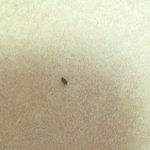 이 <b>벌레</b>가 대체 뭔가요?