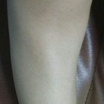 [극혐주의] 너네 피부 <b>콤플렉스</b> 있어?