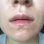 [조언부탁] [꼭봐주세요 ]유명한피부과<b>원장</b>이월요일아침부터시비걸지말래..