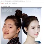 [펌] 살면서 본 <b>성형녀</b> 비포애프터 중 가장 대박!!ㄷㄷ