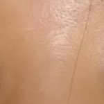 [조언부탁] 쌍수? 조언부탁해요
