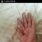 이 사진 어케 보이시나요?부딪혀 다친것처럼 보이시나요