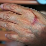 [방탈죄송] (오해생긴 내용 추가)이마트 직원 실수로 손에 화상을...