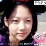 공<b>승연</b> 눈성형/과거