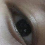 <b>눈밑</b>에주름