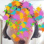 [도와주세요] 치아교정 하다가 전신마취 수술하는 억울한 사연