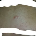 [댓글부탁해] 추가+) 욕하지마 여드름..