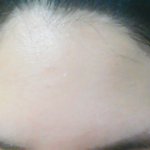 나보다<b>이마</b>넓은사람;;