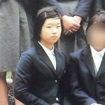 서예지 성형???