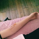 나오늘 <b>입원</b>했어ㅠ