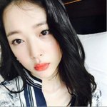 [19] <b>입술</b> 부르튼 설리