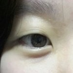 쌍수 해말아?