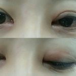 [개깊은빡침] 부산 연산동 김이*이비인후과 의사 진짜 싸가지없네...