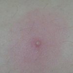 [꼭조언부탁] 약혐 몸<b>드름</b> 조언좀ㅠ