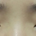 내화장<b>전후</b>.....