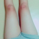 [댓글부탁해] <b>허벅</b>지살은 어떻게 빼는거..
