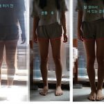 다리얇아졌어요/사진유
